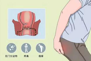 梅西官博称腹股沟有伤，健康时报：腹股沟部损伤短期很难恢复